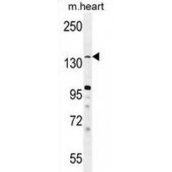 JmjC Domain-Containing Histone Demethylation Protein 2B (JHDM2b) Antibody