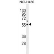 Coenzyme Q6, Monooxygenase (COQ6) Antibody