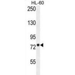 Carnitine O-Palmitoyltransferase 1, Brain Isoform (CPT1C) Antibody