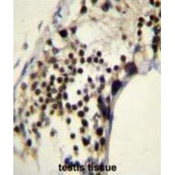 Rac-GTPase Activating Protein 1 (RACGAP1) Antibody