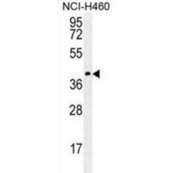 Coiled-Coil Domain-Containing Protein 54 (CCDC54) Antibody