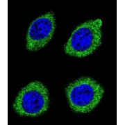 Hydroxysteroid 11-Beta-Dehydrogenase 1 Like Protein (HSD11B1L) Antibody