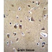 FADS6 Antibody