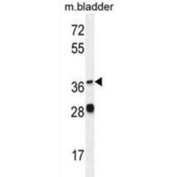 FADS6 Antibody