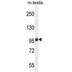Transmembrane Protein 132E (TMEM132E) Antibody