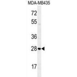 Syntaxin-19 (STX19) Antibody