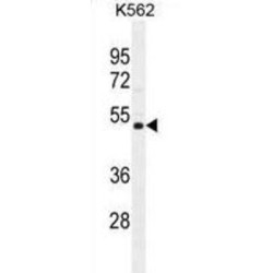 Nucleoside Diphosphate-Linked Moiety X Motif 19, Mitochondrial (NUDT19) Antibody