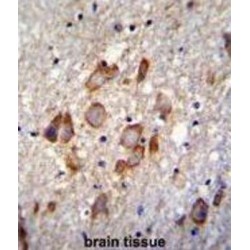 Ankyrin Repeat Domain-Containing Protein 34B (ANKRD34B) Antibody