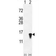 Ubiquitin-Like Protein ISG15 (ISG15) Antibody