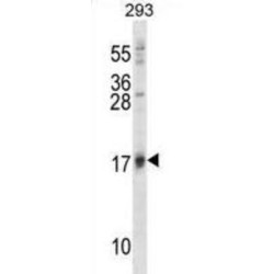 Ubiquitin-Like Protein ISG15 (ISG15) Antibody