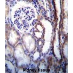 V-Type Proton ATPase Subunit B, Kidney Isoform (ATP6V1B1) Antibody