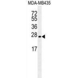 Protein Lin-28 Homolog A (LIN28) Antibody