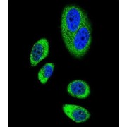 Prostaglandin G/H Synthase 2 / COX-2 (PTGS2) Antibody