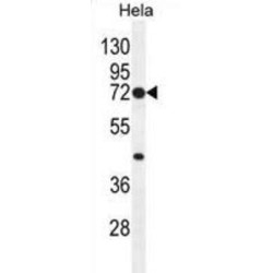 Prostaglandin G/H Synthase 2 / COX-2 (PTGS2) Antibody