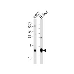 Hemoglobin Beta (HBB) Antibody