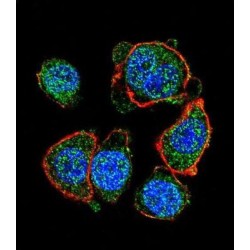 Melanogenesis Associated Transcription Factor (MITF) Antibody