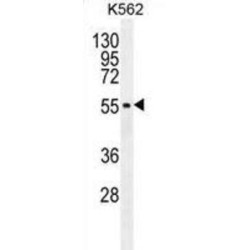 Melanogenesis Associated Transcription Factor (MITF) Antibody