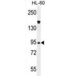 Myeloperoxidase (MPO) Antibody