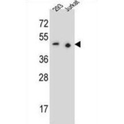 Paired Box Protein Pax-9 (PAX9) Antibody