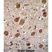 BTB/POZ Domain-Containing Protein KCTD8 (KCTD8) Antibody