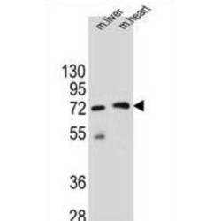 BTB/POZ Domain-Containing Protein KCTD8 (KCTD8) Antibody