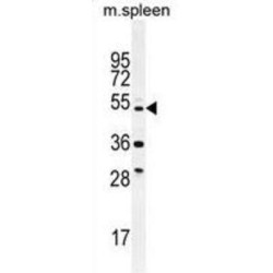 Tetratricopeptide Repeat Protein 23-Like (TTC23L) Antibody