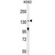 Western blot analysis of K562 cell lysates (35 µg per lane) using OVOS Antibody.