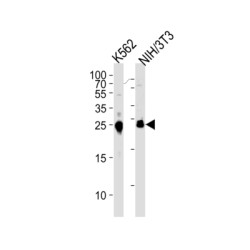 LDLR Chaperone MESD (MESDC2) Antibody