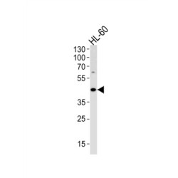 Adenosine Deaminase (ADA) Antibody