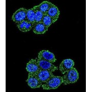 Ubiquinol-Cytochrome C Reductase, Rieske Iron-Sulfur Polypeptide 1 (UQCRFS1) Antibody