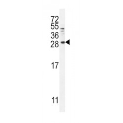 Probetacellulin (BTC) Antibody