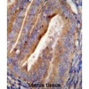 Mimecan (OGN) Antibody