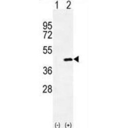 Mimecan (OGN) Antibody