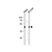 WB analysis of (1) HeLa cell line, and (2) mouse liver tissue lysates.