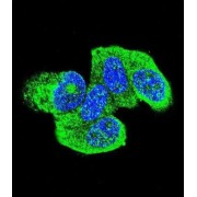 GTPase HRas (HRAS) Antibody