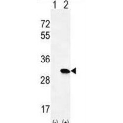 GTPase HRas (HRAS) Antibody