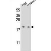 LSM7 Homolog, U6 Small Nuclear RNA And mRNA Degradation Associated (LSM7) Antibody