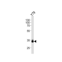 Homeobox Protein OTX2 (OTX2) Antibody