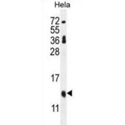 p16INK4a Antibody