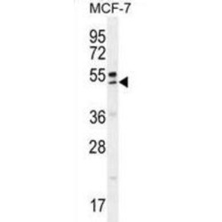 Queuine tRNA-Ribosyltransferase Accessory Subunit (QTRTD1) Antibody