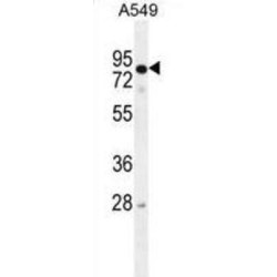 RAD17 Checkpoint Clamp Loader Component (RAD17) Antibody