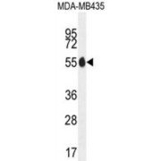 Paired Box Protein Pax-1 (PAX1) Antibody