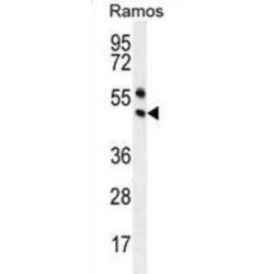 Paired Box Protein Pax-5 (PAX5) Antibody