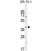 Transcription Factor Jun B (JunB) Antibody