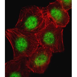 Cyclic AMP-Responsive Element-Binding Protein 1 (CREB1) Antibody