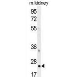 Homeobox Protein Hox-B6 (HOXB6) Antibody