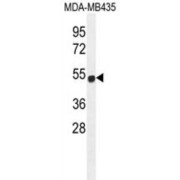 Zinc Finger Protein 286A (ZNF286B) Antibody