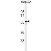 Tetratricopeptide Repeat Protein 6 (TTC6) Antibody