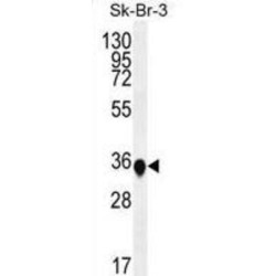 Tumor Protein P53-Inducible Nuclear Protein 1 (TP53INP1) Antibody