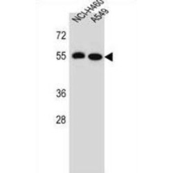 Leucine-Rich Repeat-Containing Protein 6 (LRRC6) Antibody